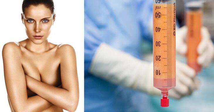 lipofilling bularra handitzeko metodo gisa